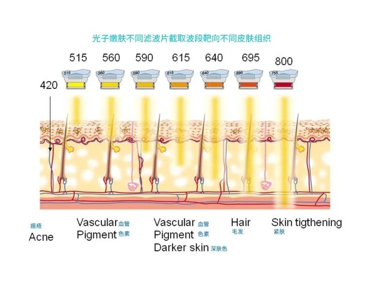 五大光子嫩膚技術(shù)（IPL、DPL、OPT、APT、BBL）及濾光片區(qū)別